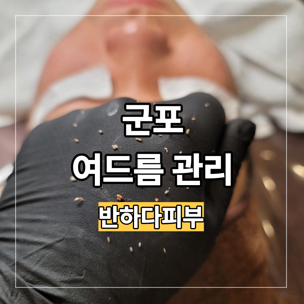 군포 여드름 피부 관리 반복되는 트러블 관리