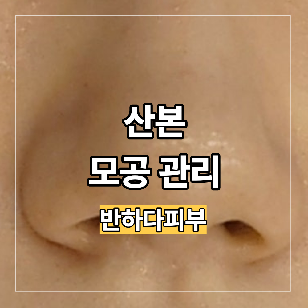 군포 산본 모공 관리 피지 블랙헤드 해결 방법